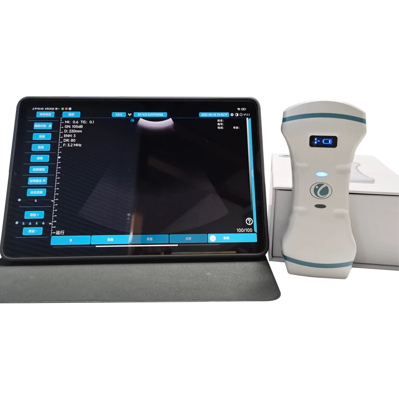 Medical Ultrasound Instruments portable  ultrasound sector scanner handheld  ultrasound machine