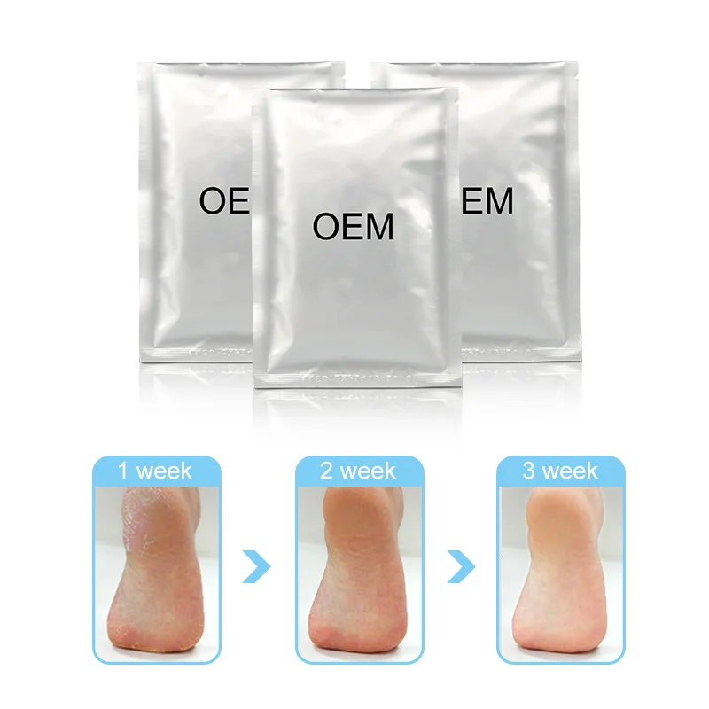 Deep moisturizing and whitening foot mask for repairing odour removal