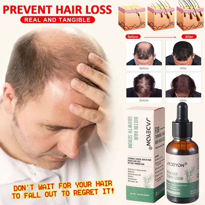 Private Label Hair Treatment Moisturizing Nourishing Pure Rosemary Oil For Hair Growth Loss Serum Natural Hair Growth Oil