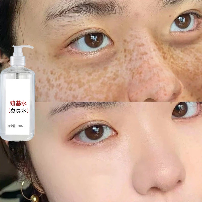 Sparse base water stinky water discharge lead and mercury to improve hormone face sensitive muscle light spot stinky water beaut