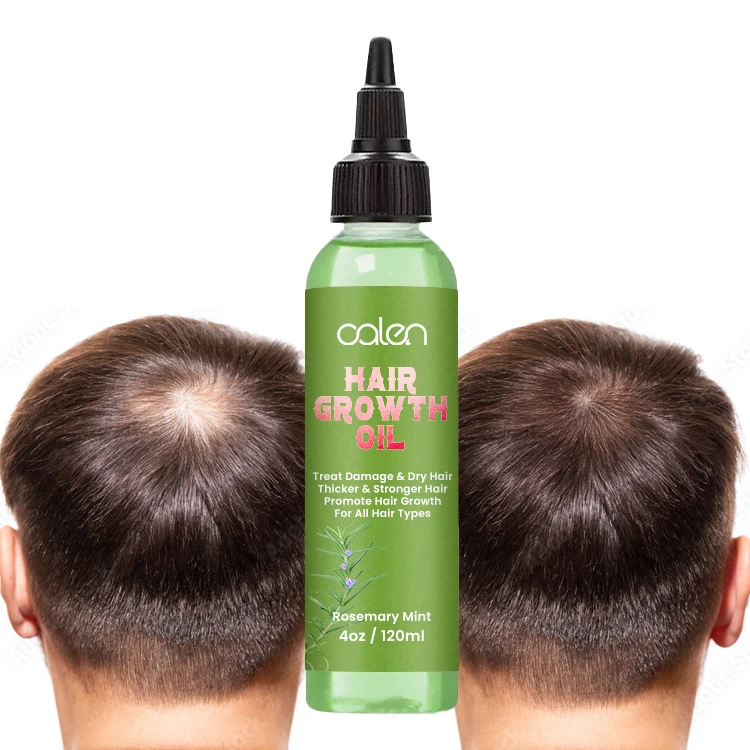 Oalen Hair Care Promote Hair Growth Massage Nourishing Saver Relieve Scalp Tension Refreshing Mint Scalp Oil