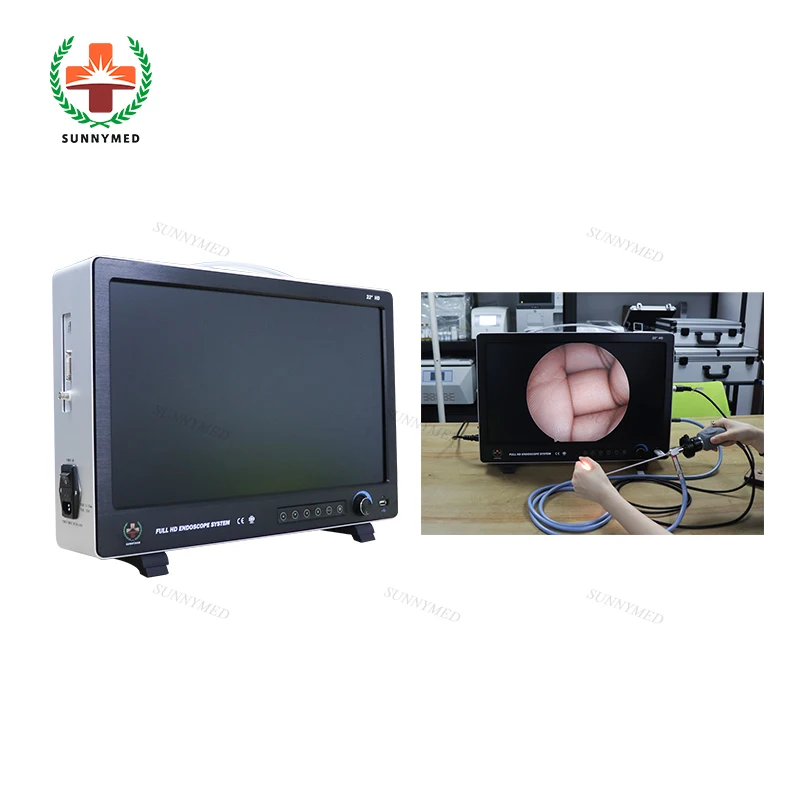 Эндоскоп HD laparascope эндоскоп для Hysteroscopy/артроскоп