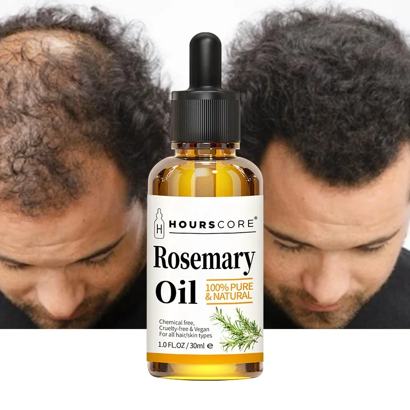100% Natural Private Label Organic Castor Essential Oils Men Women Scalp Care Serum Hair Treatment Growth Rosemary Oil