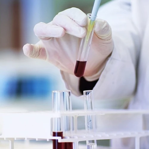 Low retention universal non-pyrogenic DNAse/RNAse free 100ul 200ul disposable laboratory micro pipette tips