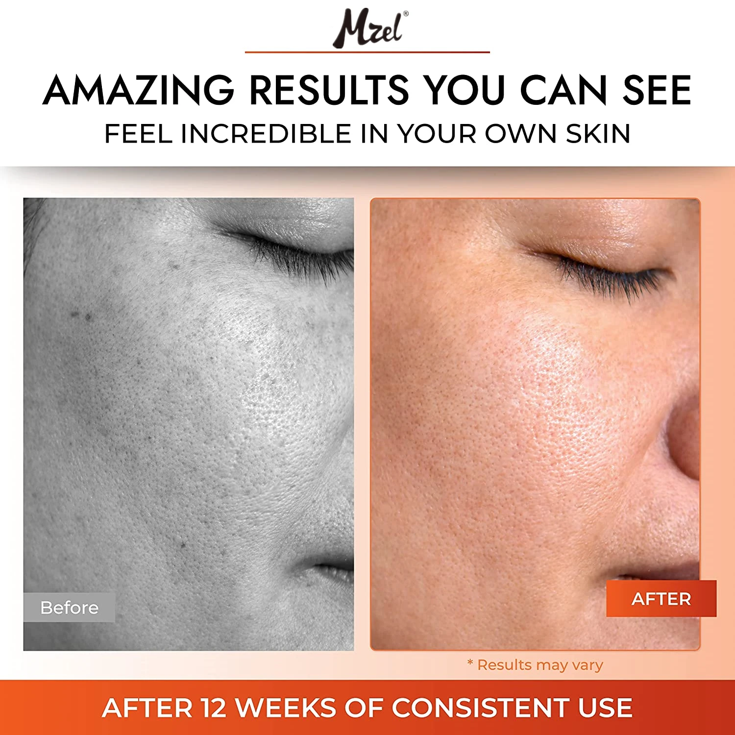 Vitamin C Serum for Face with Hyaluronic Acid, Vitamin E & Ferulic Acid for Women & Men Skin Brightening