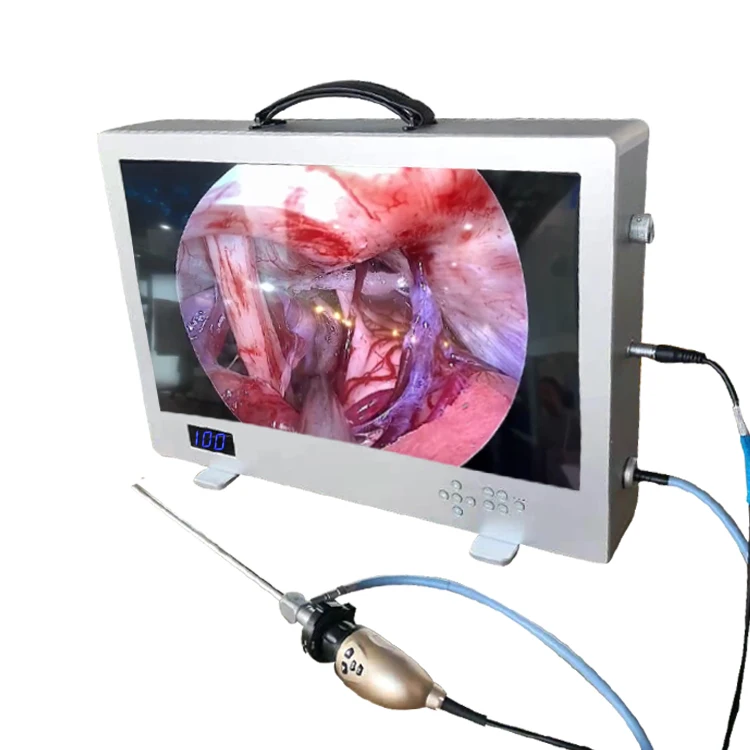 Medical Full HD Endoscope Camera Integrated With LED Light Source and 24-inch Monitor