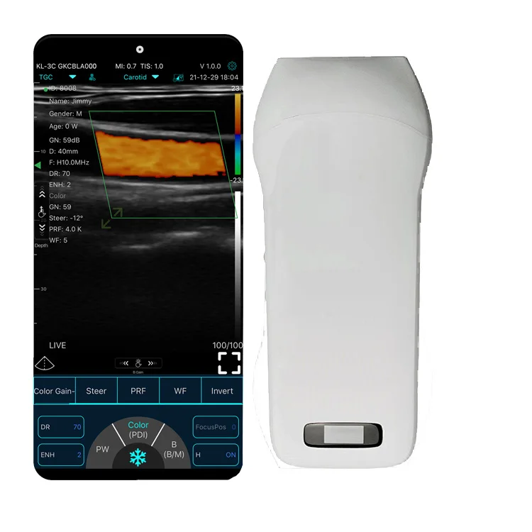 KONTED Handheld Wireless Color Doppler USG сосудистый/MSK линейный ультразвуковой зонд