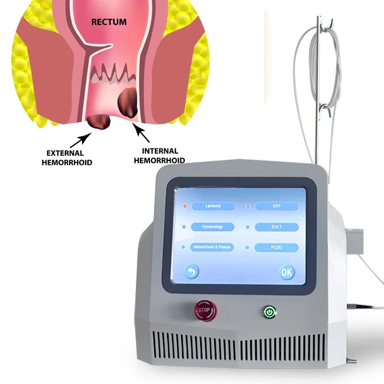 New 1470nm diode laser equipment for Hemorrhoids Fistula surgery treatment