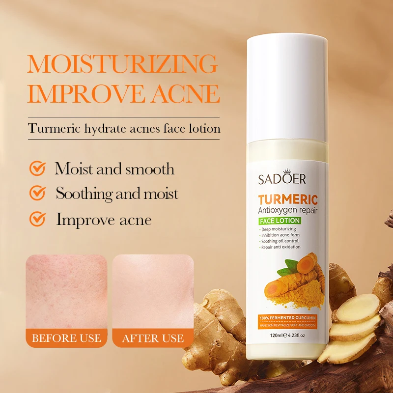 SADOER Wholesale Face Lotion Turmeric Anti-Acne Moisturizing Brightening Repair Smooth Skin Care Facial Milk Cosmetic Products
