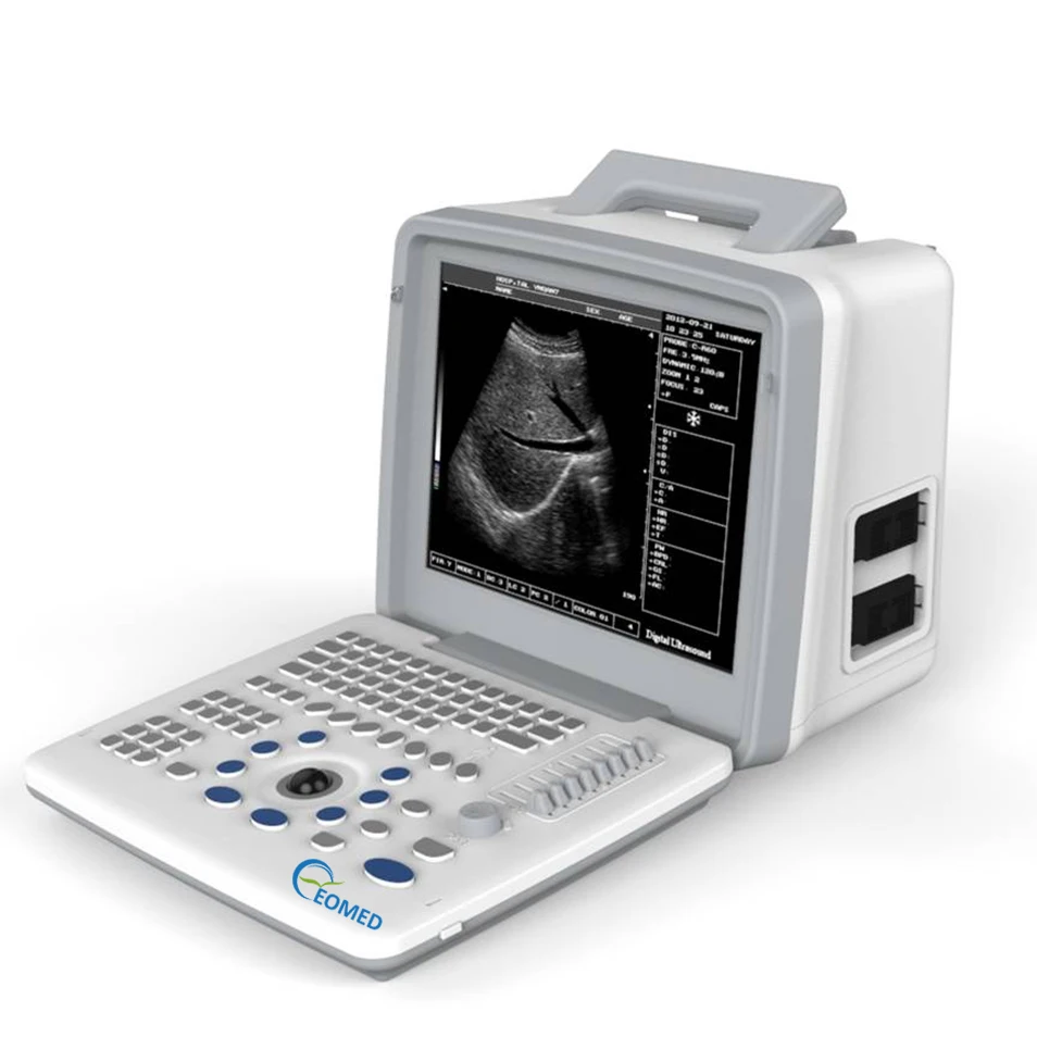BW300 Full Digital Ultrasound Diagnostic System Hospital Ultrasonic devices Ultrasound Scanner