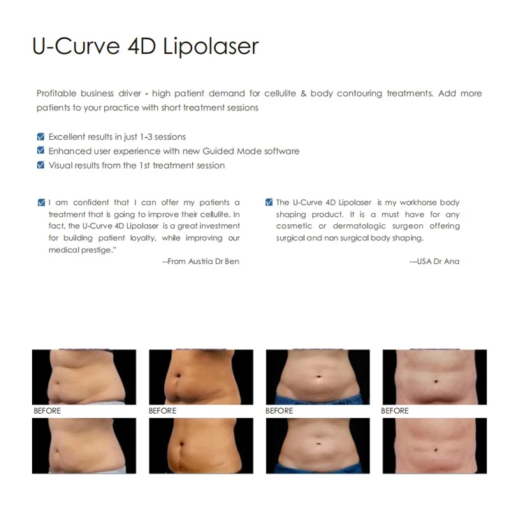 2023 Coperta Patch 40k Ultrasonic Multipolar Vacuumsli Body Sculpting Lipo Laser Weight Loss Machine