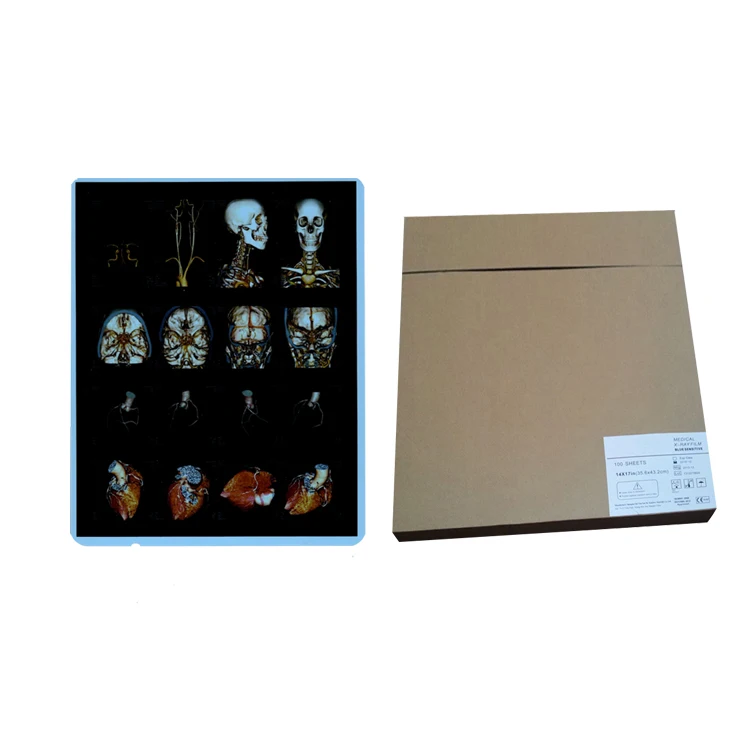 A4 8x10 280mic синяя медицинская лазерная пленка для принтера Canon Epson