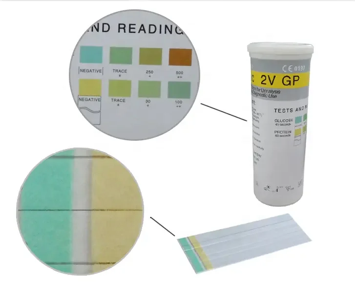 Uric-2V Urine Test Strip Urine Reagent Strips For Glucose protein