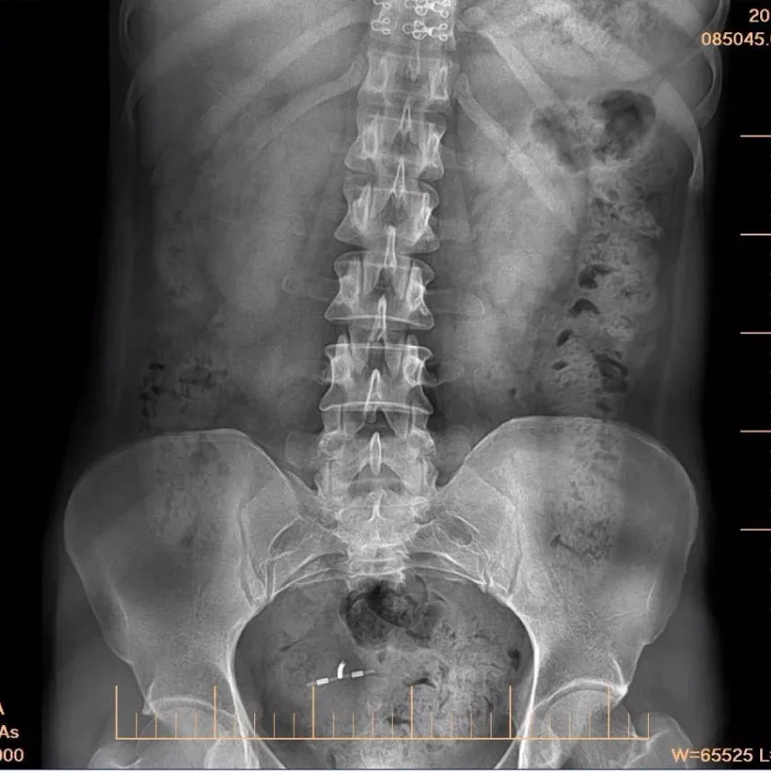 Medical imaging Equipment Wire digital x ray Flat Panel, Cassette Size Portable X-ray flat Detector