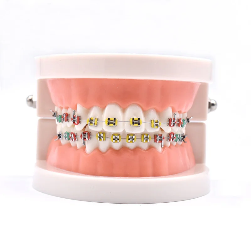 Medical Dental Favorable Orthodontics False Tooth Dental Teaching Model