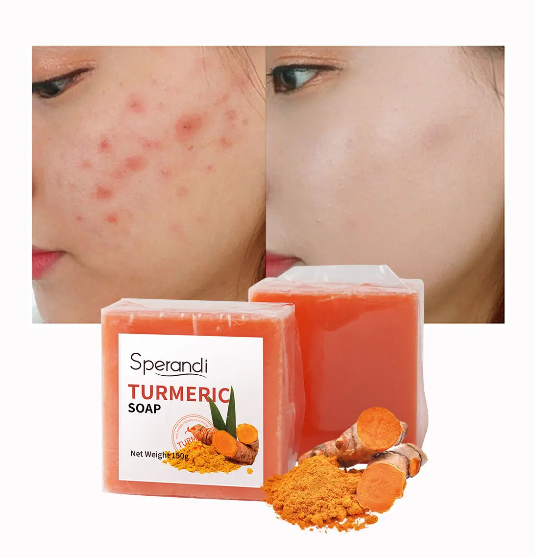 OEM Anti-acne Luxury Herbal Pure Vegan Foam Hand Made Bar Turmeric Private Label Solid Soap For Skin Care Whitening