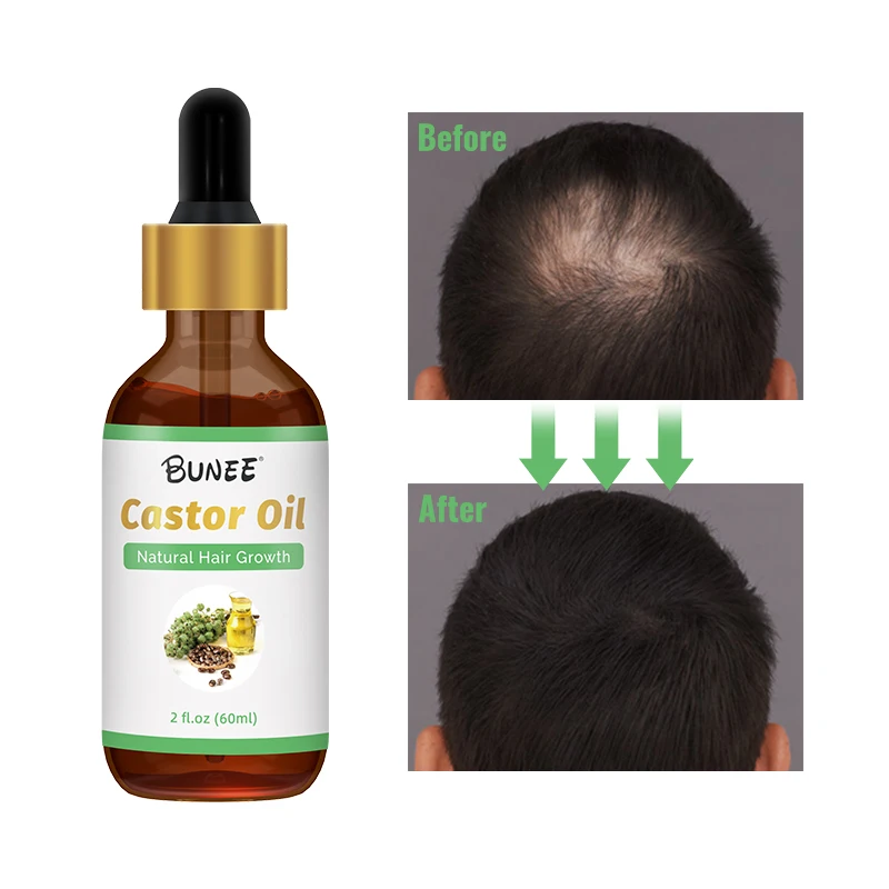Hot Products organic castor oil black seed oil cold pressed black castor oil jamaican natural fast hair growth With Hot sale