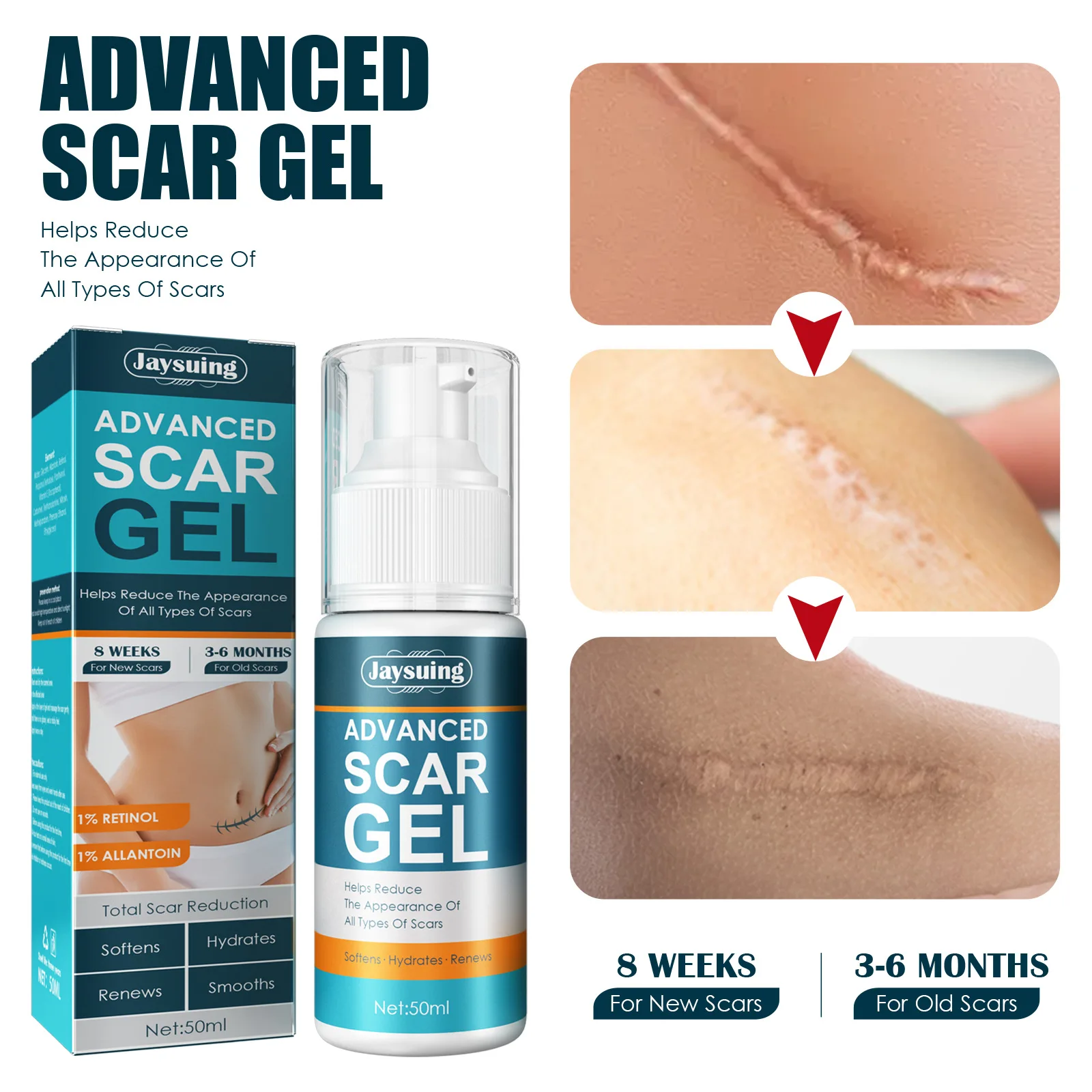 Private label Scar Gel Skin Repair  Mark Removal  Effective And Natural Skin Care Gel 50ml