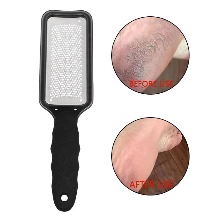 Callus Remover Corn Trimmer Colossal Pedicure Scrubber Tool Foot Rasp File