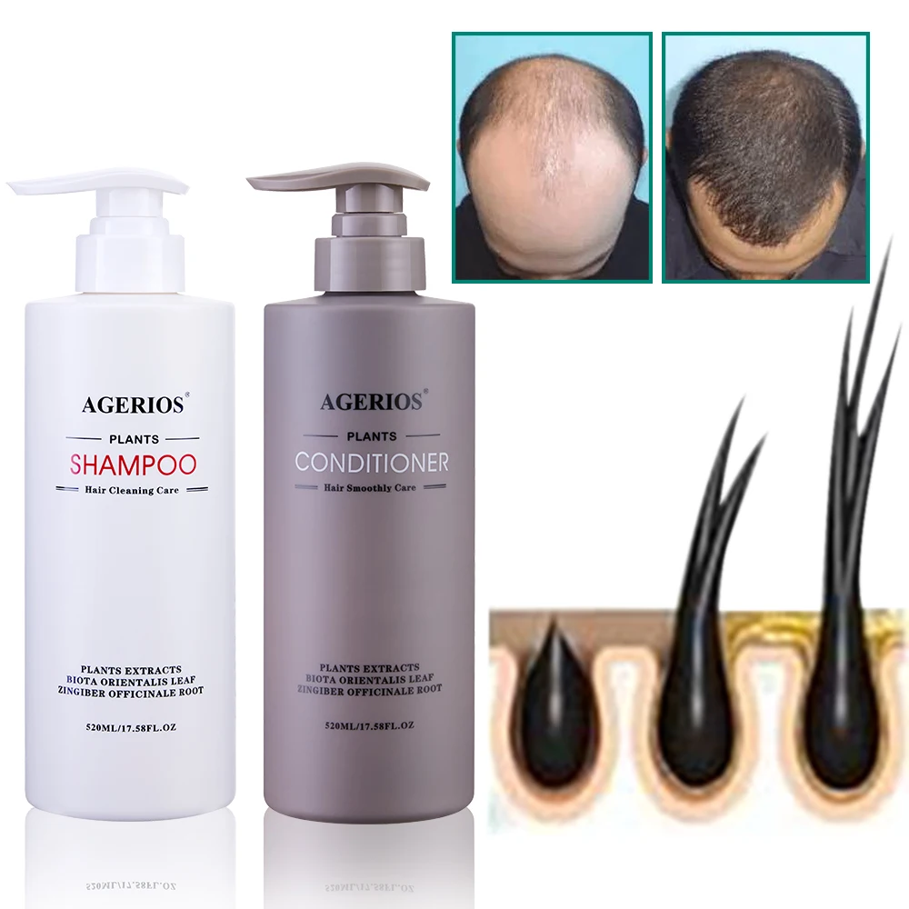Agerios Plant Extract Hair loss shampoo and conditioner for African black braid hair Private label hair grow faster shampoo