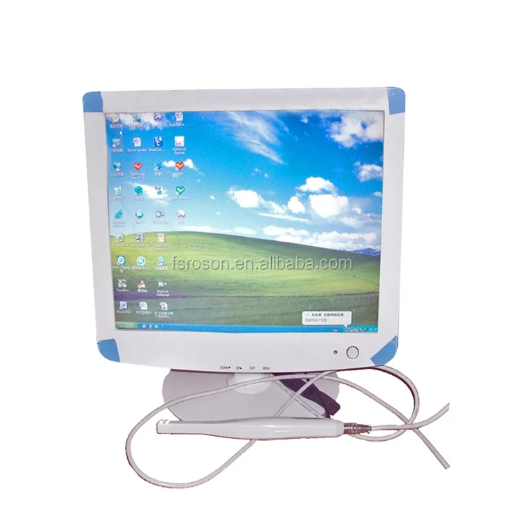 dental intraoral camera with 15 inch monitor price for teeth x ray
