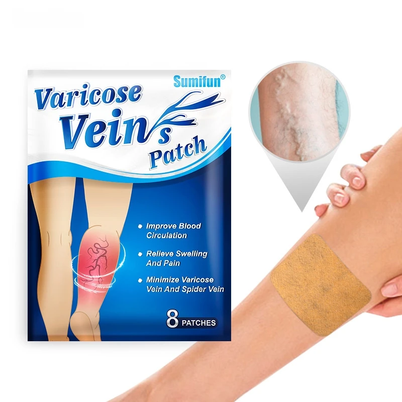Varicose Veins Cream Ointment Spider Veins Pain Varicosity Angiitis Remedy Removal Herbal patch