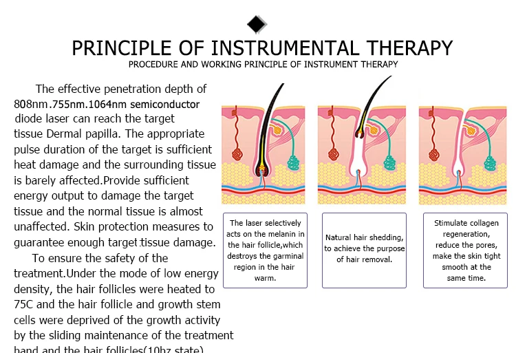 professional hair removal machine price painless laser diode hair laser removal machine