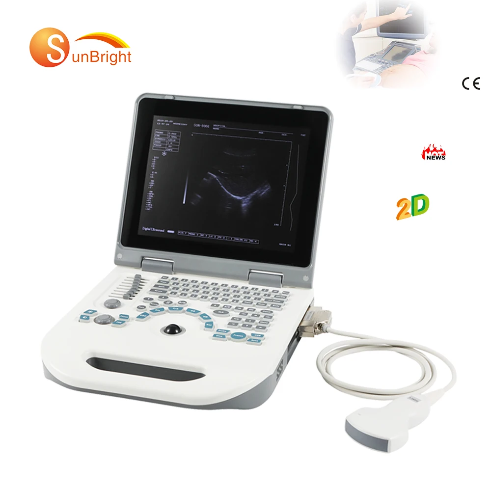 Ultrasound machine abdominal cardiac portable usg clinic hot selling