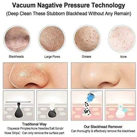 Skin Care Tool Blackhead Remover Vacuum Pore Cleaner Facial Nose Blackhead Remover