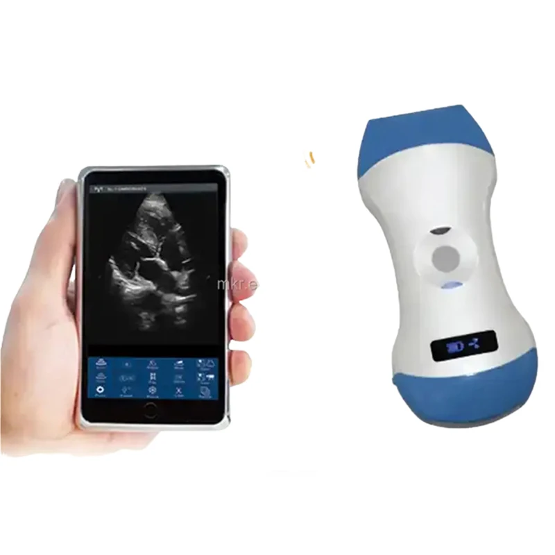 High Quality Medical Handheld Modern Design Hospital Medical Portable Ultrasound Scanner For Human Being