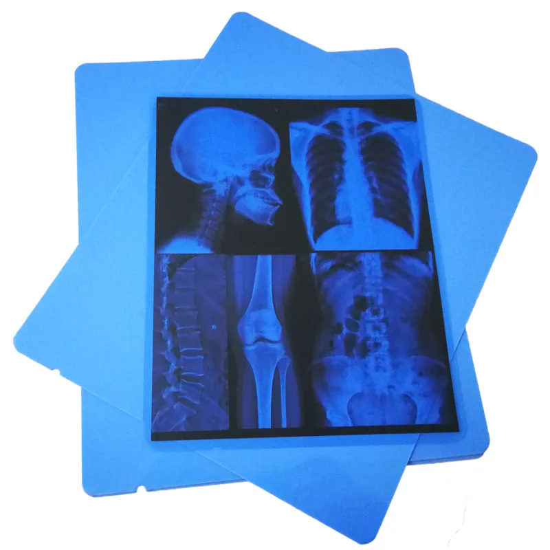 Высокая острота 11x14 дюймов синий Xray сухая ПЭТ Лазерная Медицинская пленка