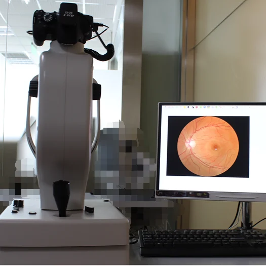 SK-650B cheapest ophthalmic equipments retina camera FFA digital eye test analysis machine auto fundus camera