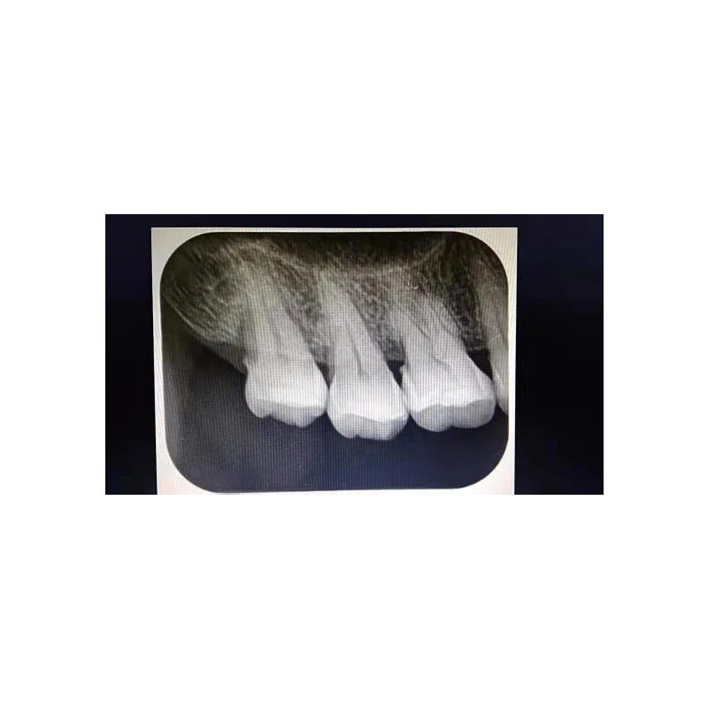 High Frequency Portable Dental X-ray Machine