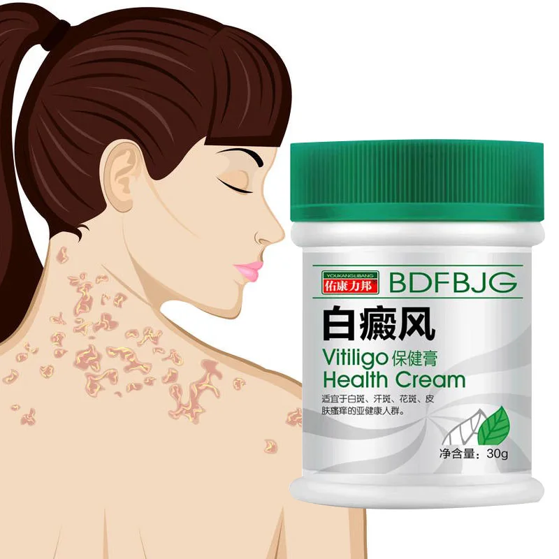 30G Vitiligo Treatment Cream Antibacterial Cream Psoriasis Localised Vitiligo Ointment White Spots Mycosis Leukoplakia Treatment