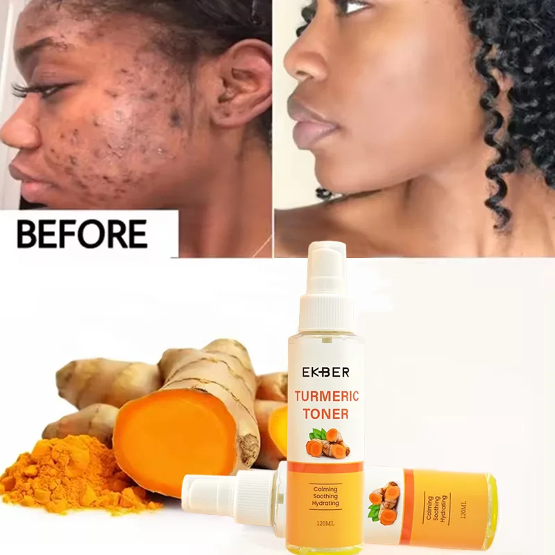 Private Label Organic Turmeric Facial Toner Fades Blemishes anti acne reduce swelling pain redness Face Turmeric Toner