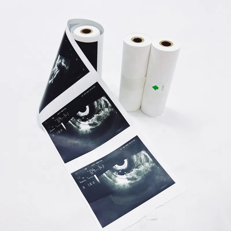 110*18m 110*20m High Gloss Thermal Ultrasound Printing Paper UPP 110HG 110S
