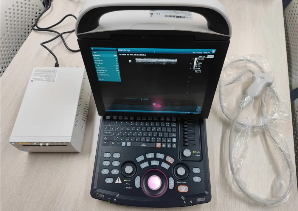 Hot Sale high performance Original Ultrasonic Diagnostic Imaging System 4D Color Doppler Mindray DP-10 Ultrasound