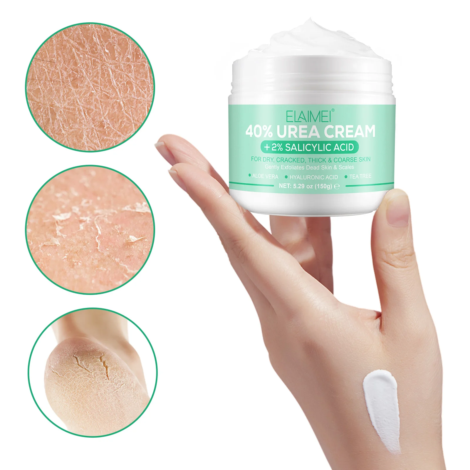 ELAIMEI foot skin care custom logo exfoliation 150g moisturizing body urea skin cream 2% salicylic acid urea 40% foot cream