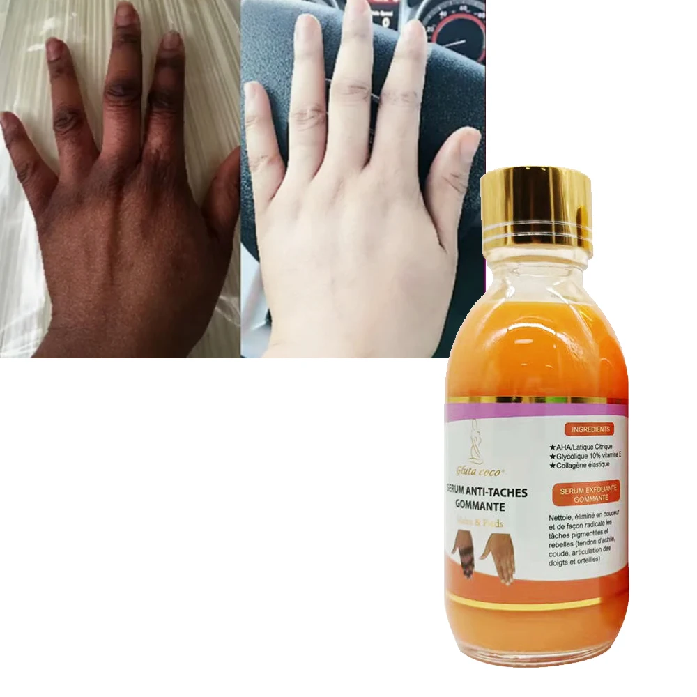 Dark Knuckle Remover Whitening Serum Hand Knuckle Glow Oil Dark Spot Body Facial Serum Skin Whitening Serum For Black Skin