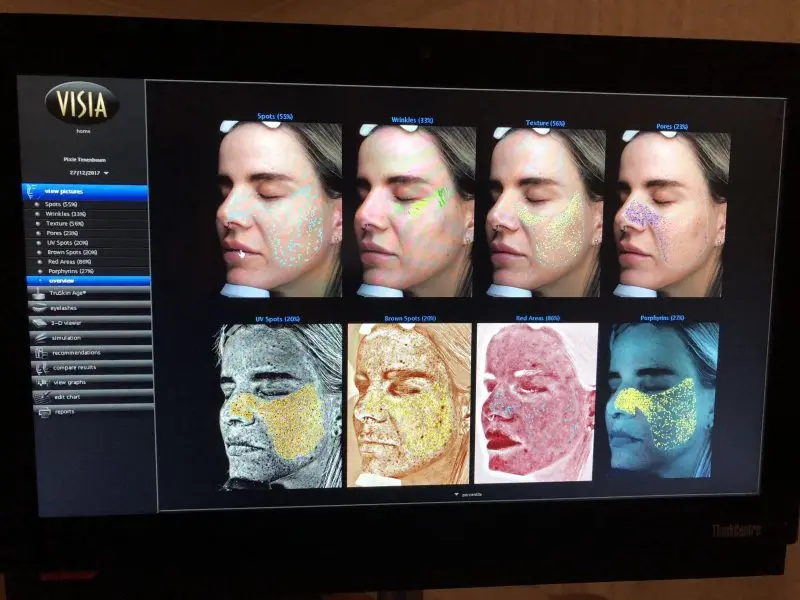 Visia Skin Analyzer Face Skin Dialysis Machine Skin Diagnosis Device