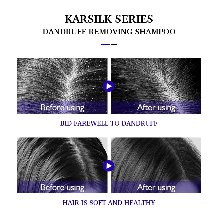 500ml Deeply Clean Anti-Itching Anti-Dandruff Natural Herbal Keratin Shampoo Set Hair Treatment OEM Hair Shampoo