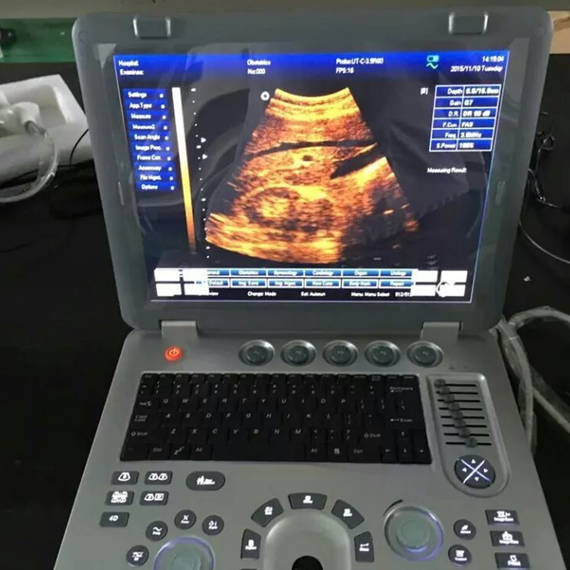 SUN-800D Manufacturer Hospital device Ultrasound Machine 3D diagnostic Scanner ecografo portatil Laptop BW Vet ultrasound