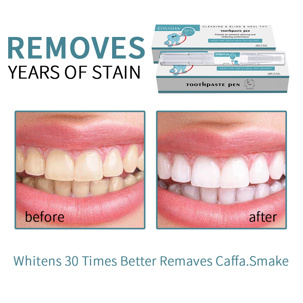Professional Travel-Friendly Teeth Whitening Pen Whiten Teeth Stain Remover Tooth Whitening Bleaching Pen