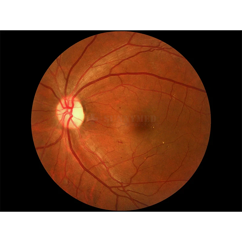 SY-V036-1 Eye Fundus Camera FFA / Retina Camera Non-Mydriatic Retinal Fundus Photography For Ophthalmology