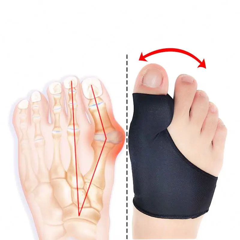 Wholesale Custom Reasonable Price Hallux Valgus Splint