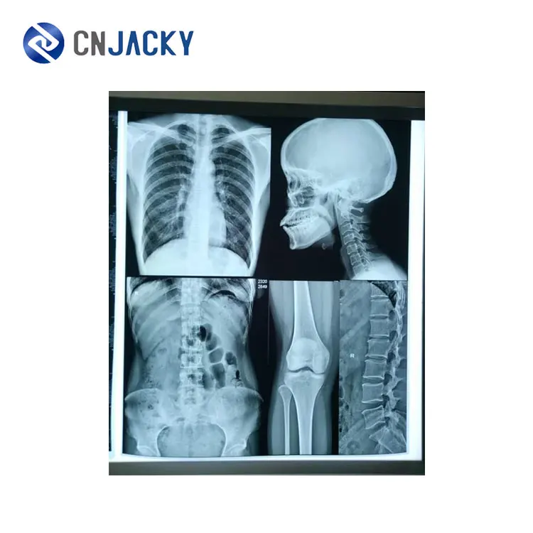 Cheap medical blue green sensitive medical dental x-ray film