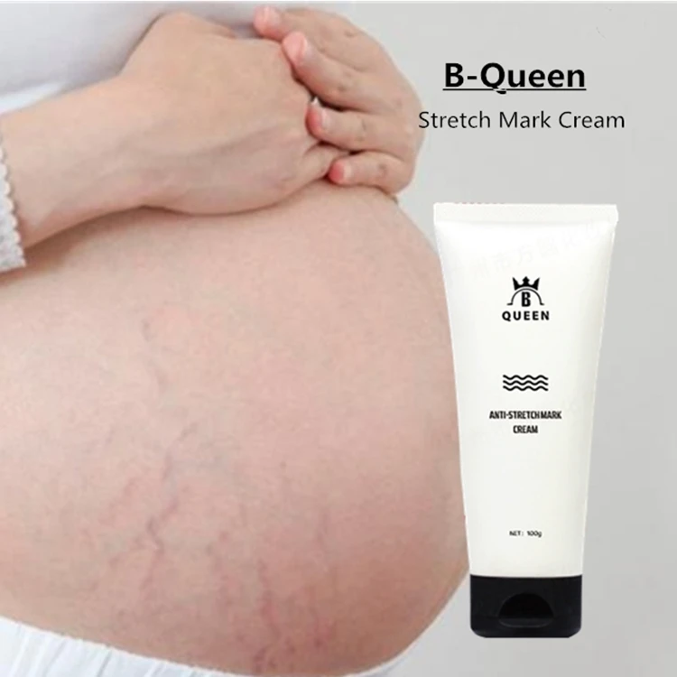 100% Organic Effective Stretch Mark Treatment Cream with Private Label