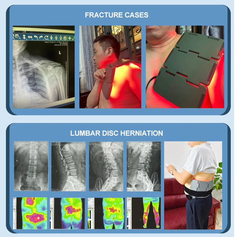 Shoulder LED Light Therapy Infrared Pain Relief Bone Recovery Soft Tissue Repair Body Pain Relief Knee Massager