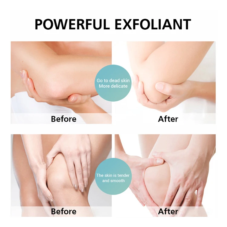 OEM recipe dropshipping guangzhou lady eczema fragrance body butter with shea butter body butter set