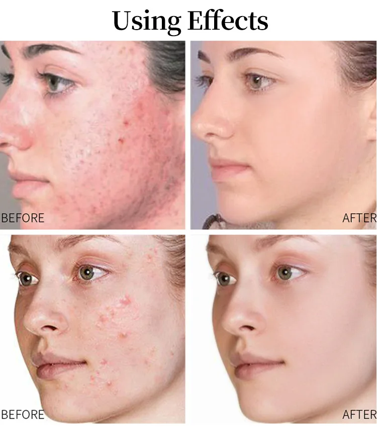 Private Label Skin Care Serum Vitamin E OEM Organic 20% Hyaluronic Acid Anti Aging Brightening Wrinkle Face Vitamin C Serum